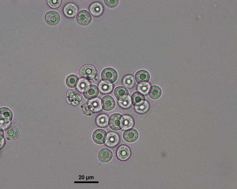 Research project identifies microalgae with health-giving omega-3-type fatty acids
