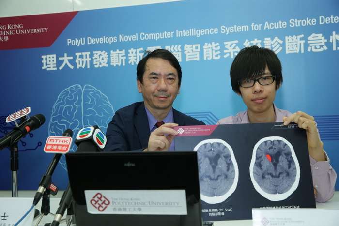 Researchers develop novel computer intelligence system for acute stroke detection