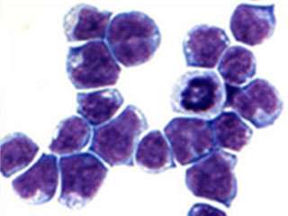 Researchers identify potential new leukemia drug target