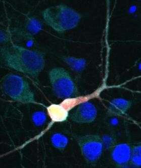 Scientists identify new drug target to treat ALS