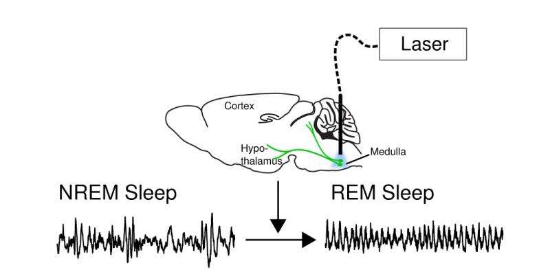 Researchers find neural switch that turns dreams on and off