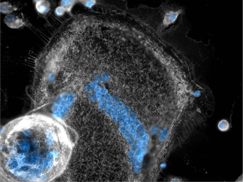Researchers unravel abilities of the immune system’s giant cells
