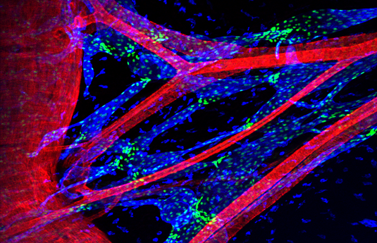 Researchers describe regulatory protein controlling the patterning of the lymphatic system