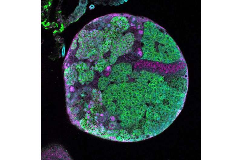 Researchers find molecular shift that stops stem cells in Drosophila from making tumors
