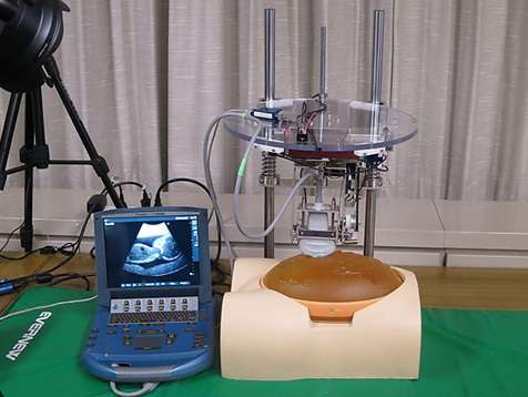 A diagnostic robot for remote prenatal ultrasound exams