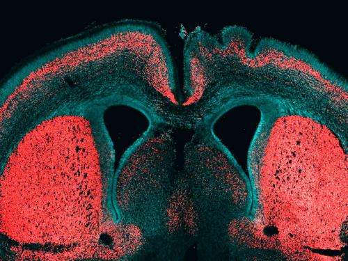 A gene for brain size only found in humans