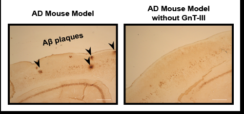 Alzheimer's plaques reduced by targeting sugar attachment to the BACE1 enzyme