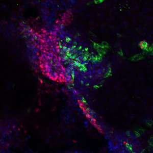 A master gene determines whether cells become pancreatic or liver cells