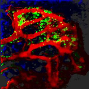 鼠标应变给予最详细的可视化的免疫细胞在骨髓中