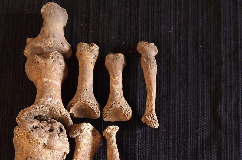Ancient skeleton shows leprosy may have spread to Britain from Scandinavia