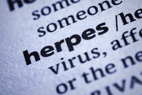 An estimated two-thirds of world’s population under age of 50 are infected with herpes simplex virus type 1