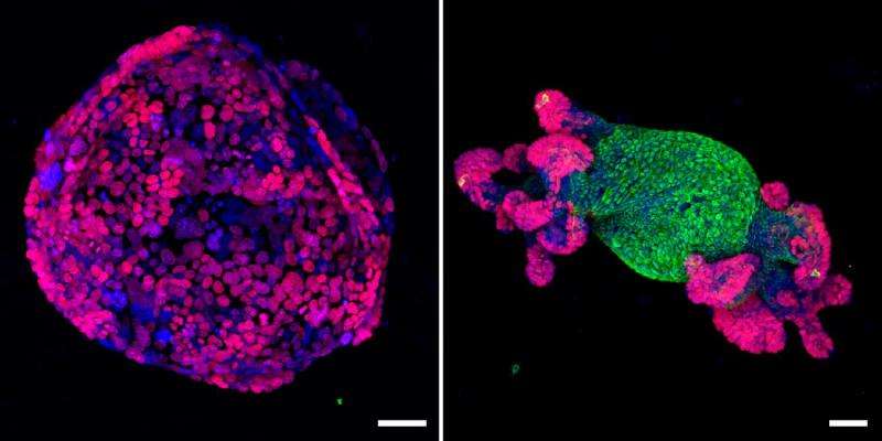 A single gene turns colorectal cancer cells back into normal tissue in mice