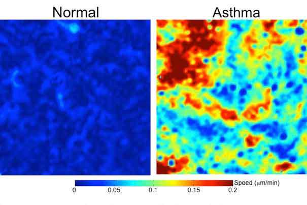 Asthma cells scramble like ‘there’s a fire drill’