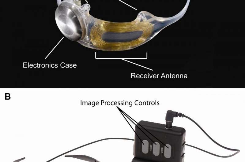 Bionic eye clinical trial results show long-term safety, efficacy vision-restoring implant