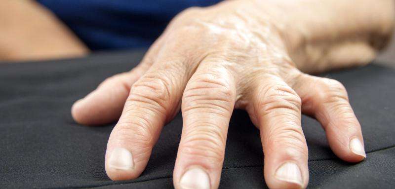 Blood test that could predict arthritis risk