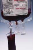 Blood transfusions during heart surgery may up pneumonia risk