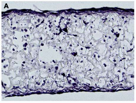 Bone cells (osteocytes) grown using Alvetex