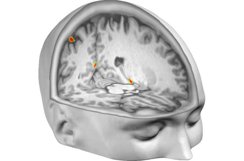 Brain scan reveals out-of-body illusion