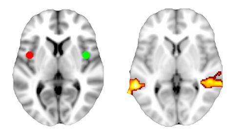 Brain scans predict effectiveness of talk therapy to treat depression