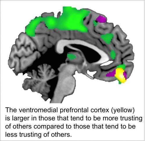 Brain structure varies depending on how trusting people are of others, study shows