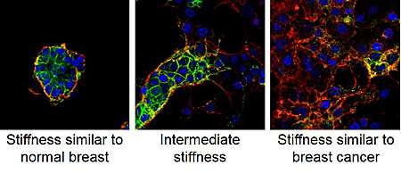 Breast tumor stiffness and metastasis risk linked by molecule's movement