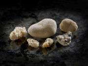 Calcium supplements tied to kidney stone risk in study