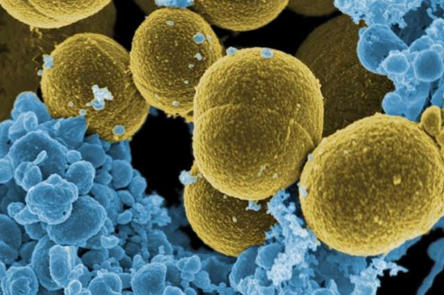 Calprotectin fends off microbial invaders by limiting access to iron