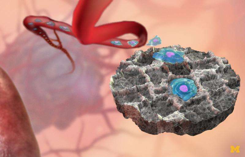 Cancer decoy could attract, capture malignant cells