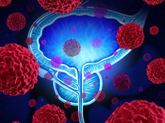 “Cancer driver gene” reduces metastasis in prostate cancer