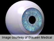 Cataract risk not down with long-tem selenium, vitamin E