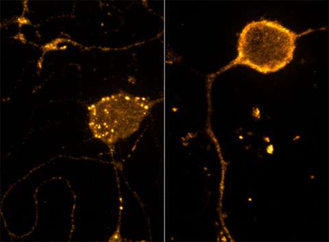 Cellular signals for pain fine tune neurons' sensitivity to opiods