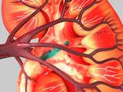 Central venous pressure-guided hydration beneficial in CKD, CHF