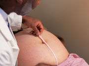 Cesarean rate not significantly impacted in induction study