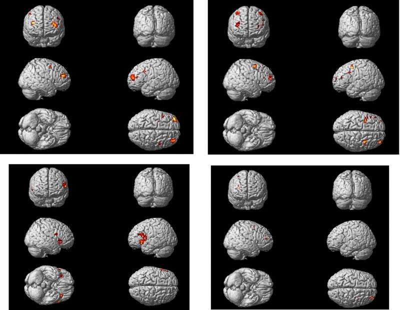 Changing activity in the ageing brain