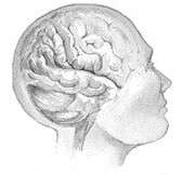 Chemoradiation for glioblastoma takes toll on brain