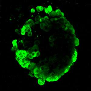 Clear imaging of pancreatic cells through the development of a novel fluorescent probe