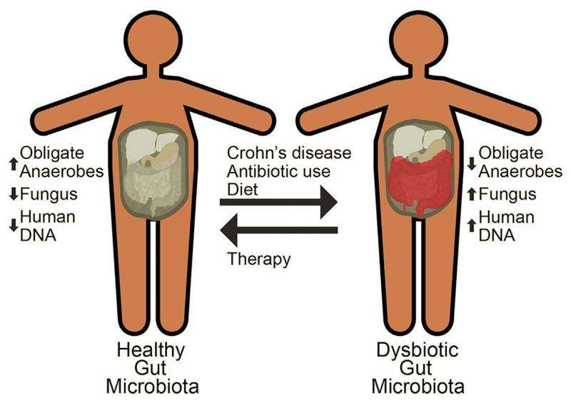 Crohn的疾病治疗不会完全恢复儿童健康的肠道微生物