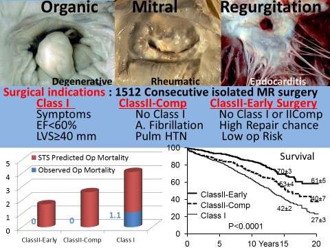 Early surgery for mitral regurgitation, before clinical triggers emerge, has best outcomes