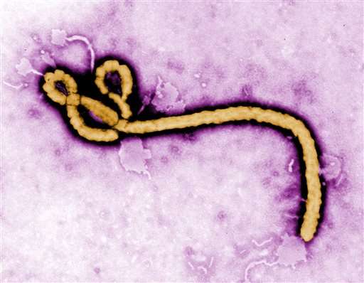 埃博拉病毒存在于医生的眼睛个月后留下的血