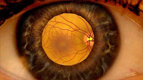 Eylea outperforms other drugs for diabetic macular edema with moderate vision loss