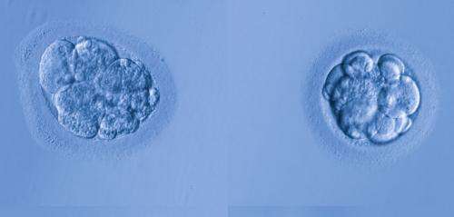 Female embryos less likely to survive to birth