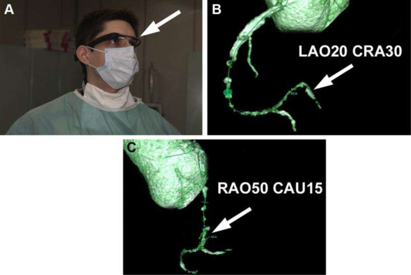 First-in-man use of virtual reality imaging in cardiac cath lab to treat blocked coronary artery