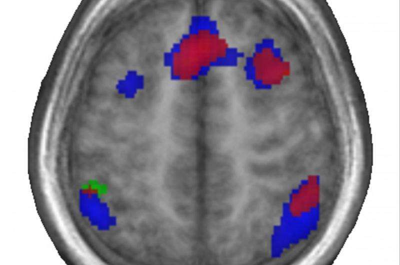 First language wires brain for later language-learning