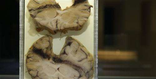 Forensics exhibition shows how science can make dead speak