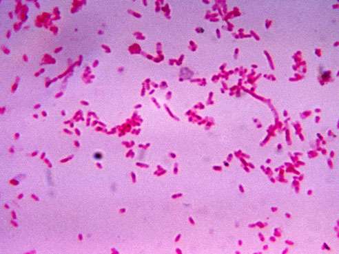 Forgotten bacterium is the cause of many severe sore throats in young adults