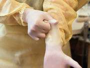 Glove-related hand urticaria may be rising in health care workers