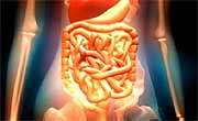 Half of colorectal cancer survivors have continued pain