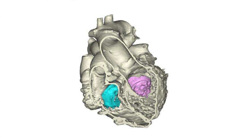 Helen DeVos Children's hospital prints first 3D heart using multiple imaging techniques