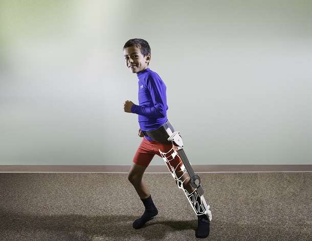Helping injured children walk, one step at a time