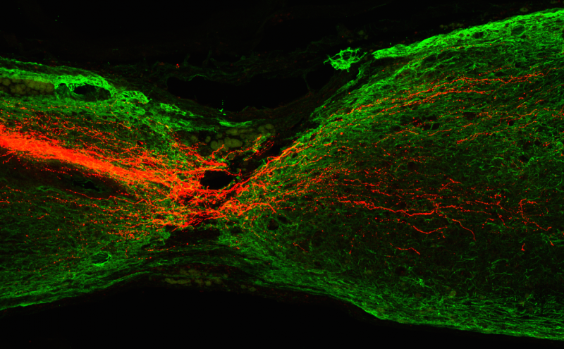 HKUST Researchers discovers ways to regenerate corticospinal tract axons